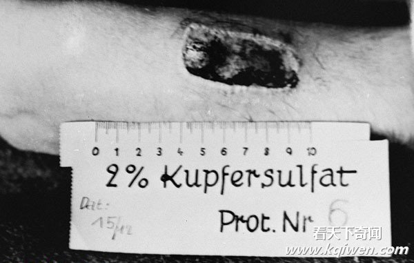 �ҿ���սʱ�¹��ɴ����˷�ָ�ı��� ����Ӫʬ����(��ͼ)